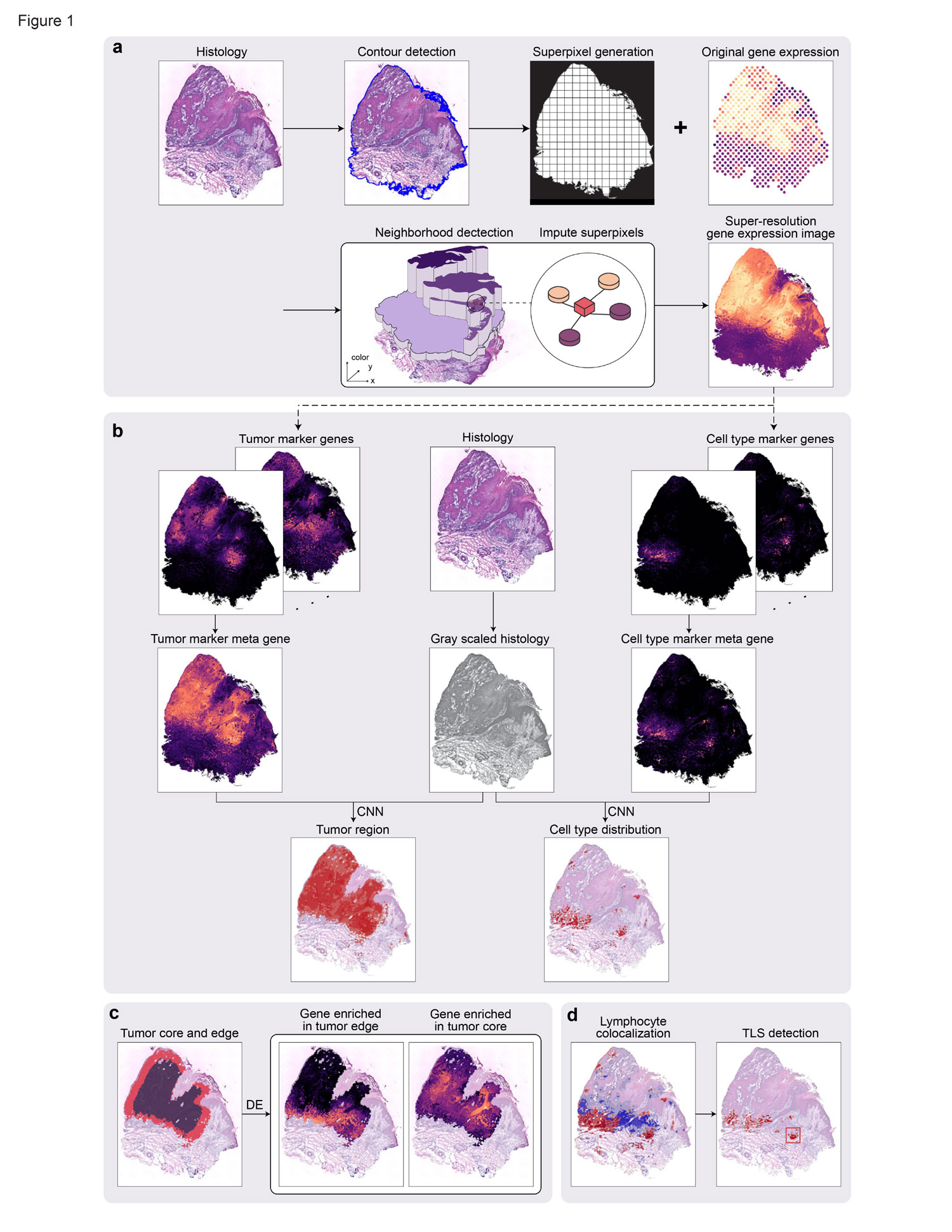 Deciphering tumor ecosystems at super resolution from spatial transcriptomics